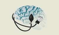کاهش فشارخون 35 تا 40 درصد خطر سکته‌های مغزی را کم می‌کند